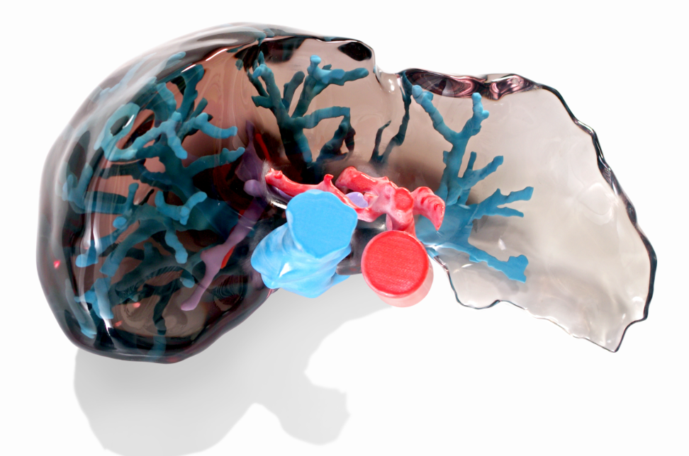 A 3D printed liver model with transparent tissue.